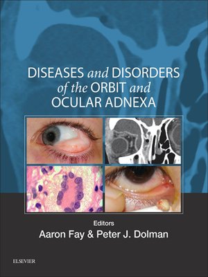cover image of Diseases and Disorders of the Orbit and Ocular Adnexa E-Book